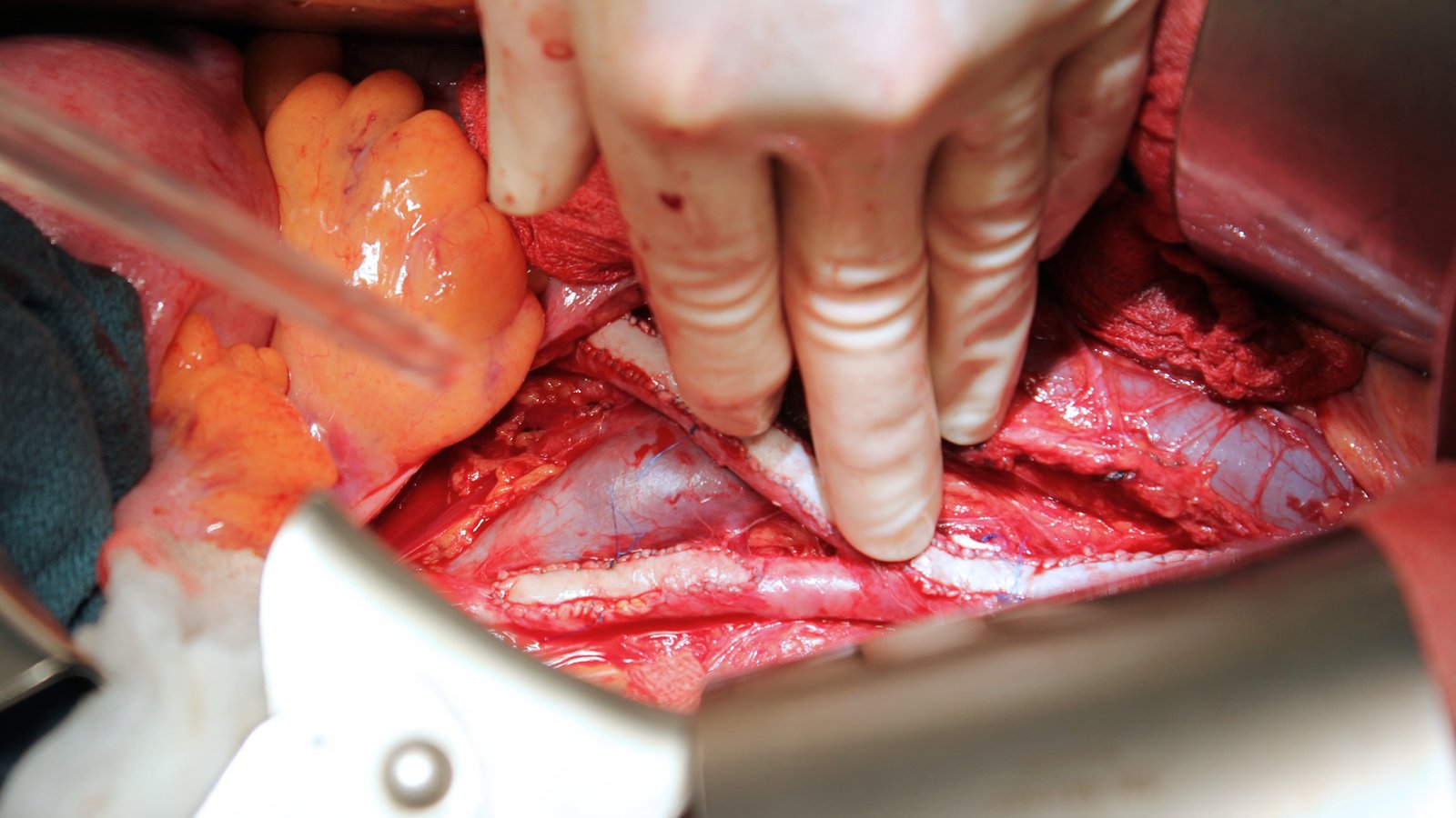 Hands-on Vascular Surgery Workshop